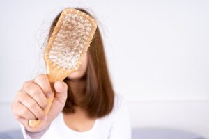 hair loss and support